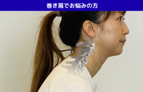 巻き肩でお悩みの方